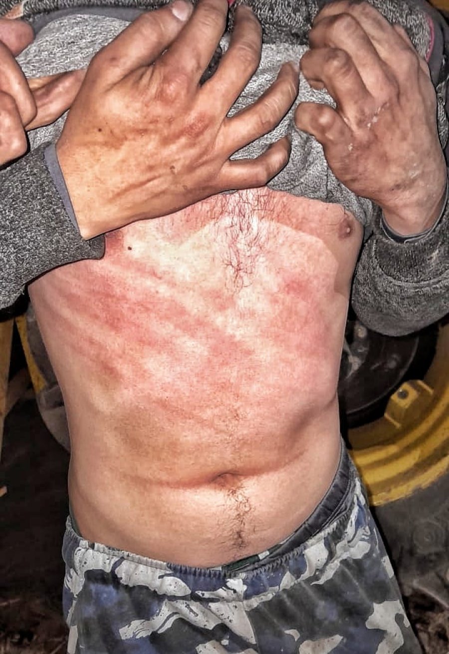 Las marcas fueron registradas en fotograf&iacute;as por su cumpa&ntilde;ero.