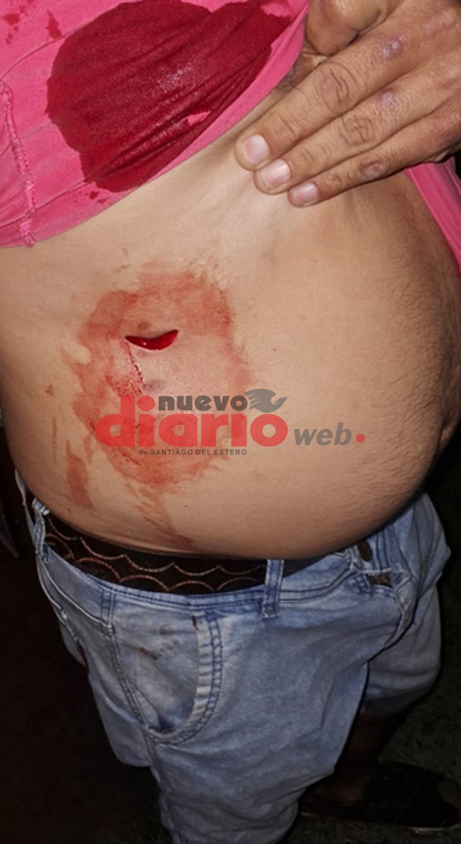 <b>Ord&oacute;&ntilde;ez sufri&oacute; una herida punzocortante de 3 cent&iacute;metros.</b>