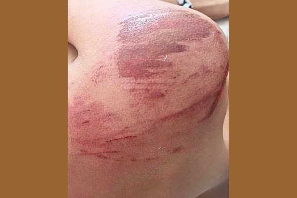 En una juntada, sus amigos le robaron un celular y le propinaron una paliza