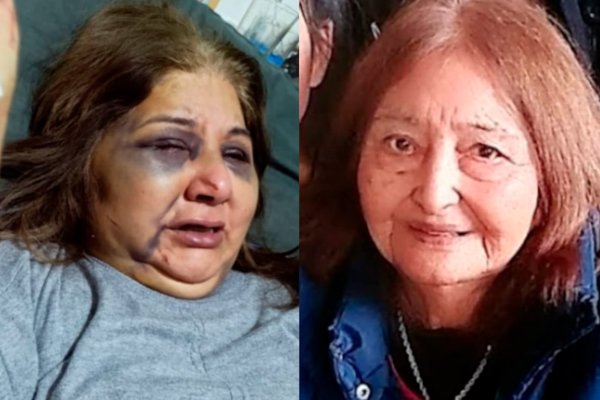 Fue atacada por su esposo y se salvó gracias a que su mamá dio la vida por defenderla