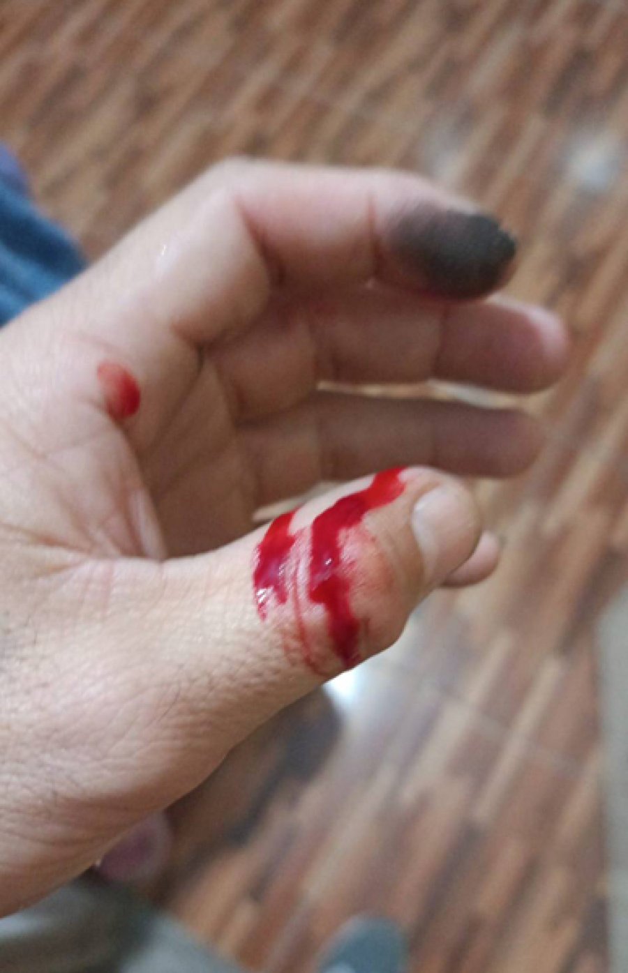 Tambi&eacute;n sufri&oacute; un corte en la mano izquierda.
