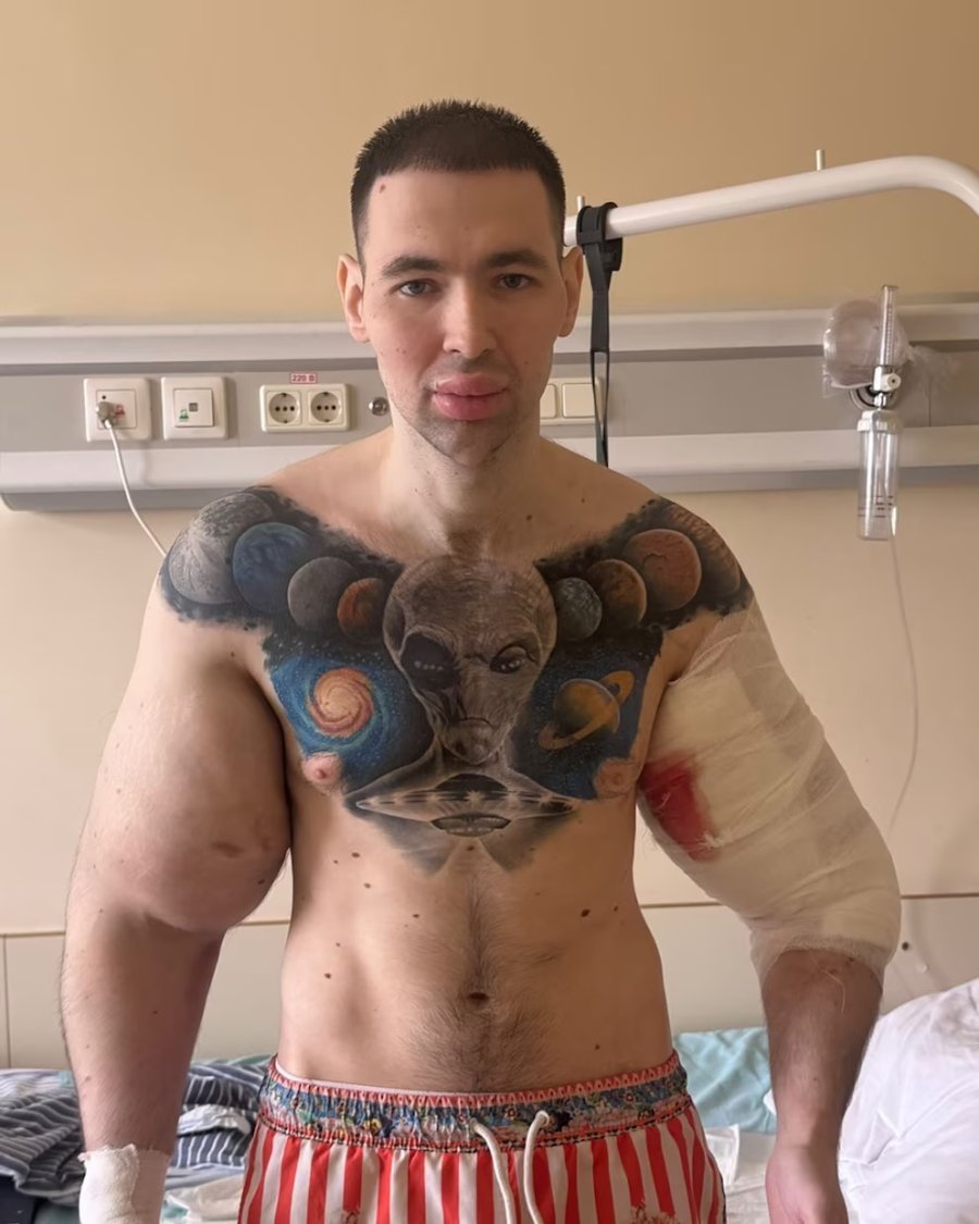 En el hospital, con un brazo vendado. (@kirilltereshin96).