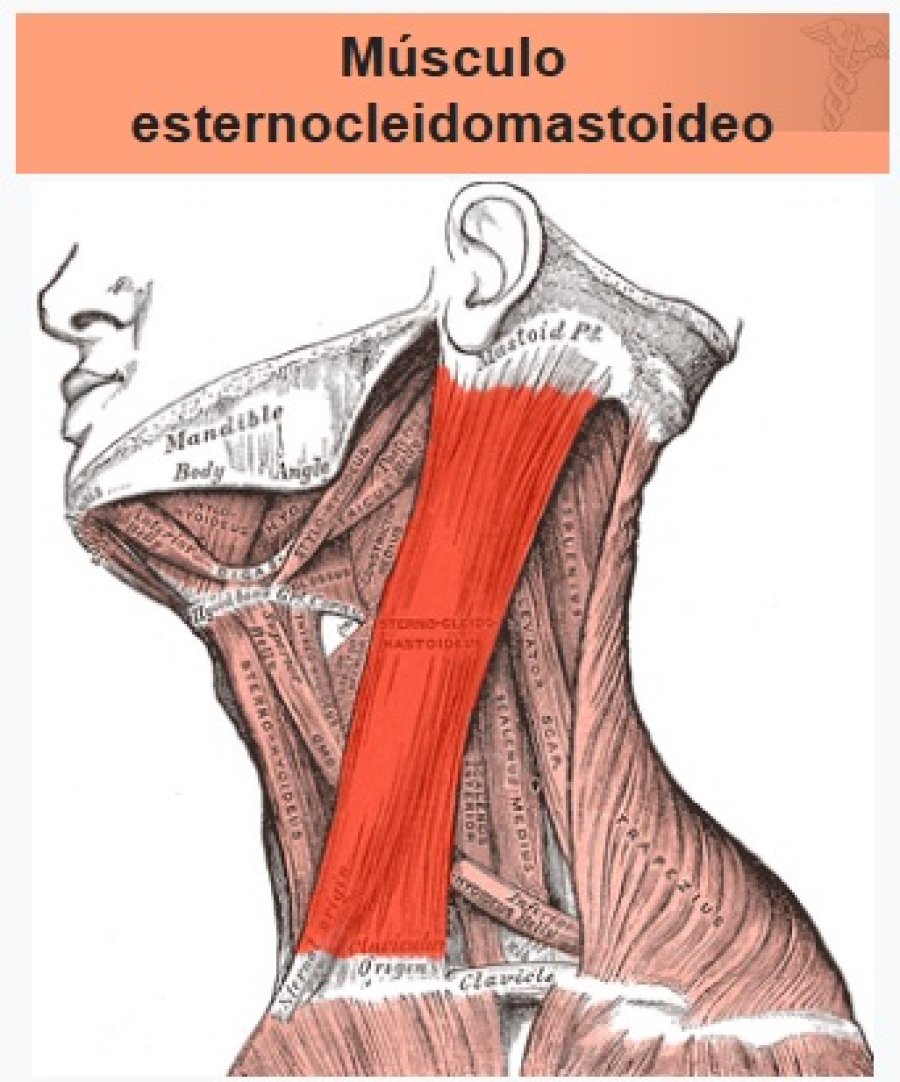 Es el principal m&uacute;sculo del cuello.