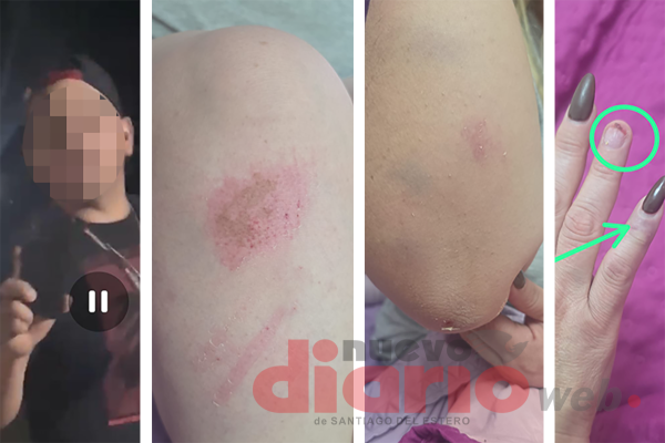 Una docente fue a reclamar por la música a su vecino y fue ferozmente golpeada