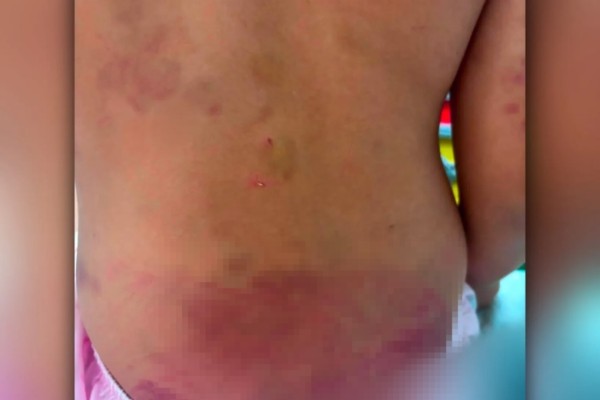 Detuvieron a un joven acusado de golpear a su hijastra de 6 años con autismo